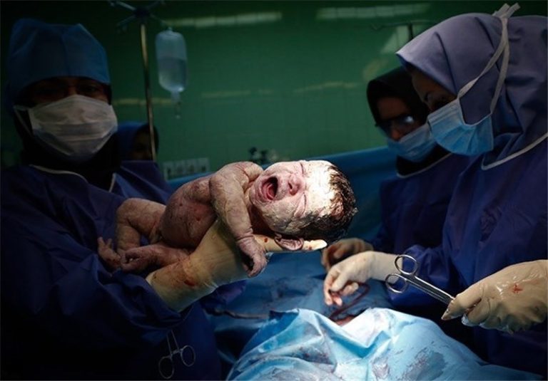 زایمان طبیعی