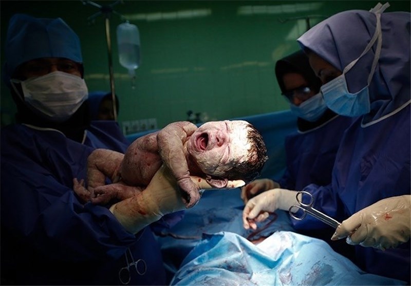 زایمان طبیعی