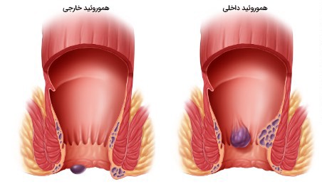 رابطه جنسی معقدی