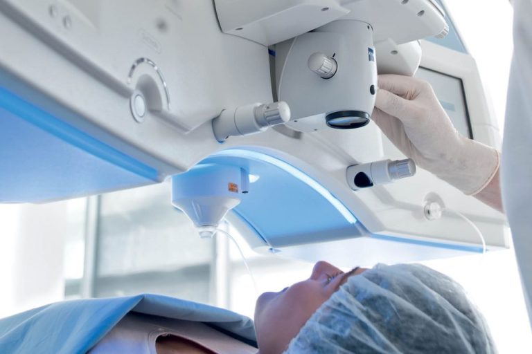 عمل لیزیک چشم