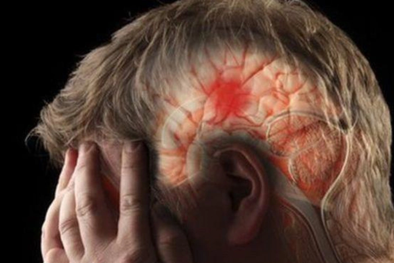 راهکارهای درمان خشکی مغز